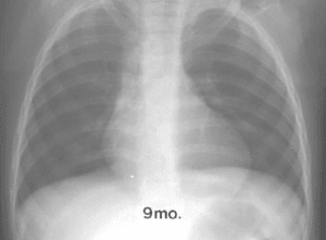NEET SS X ray 